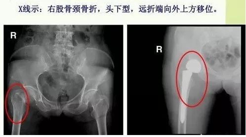 地毯拉力什么意思_地毯拉伸_地毯拉力